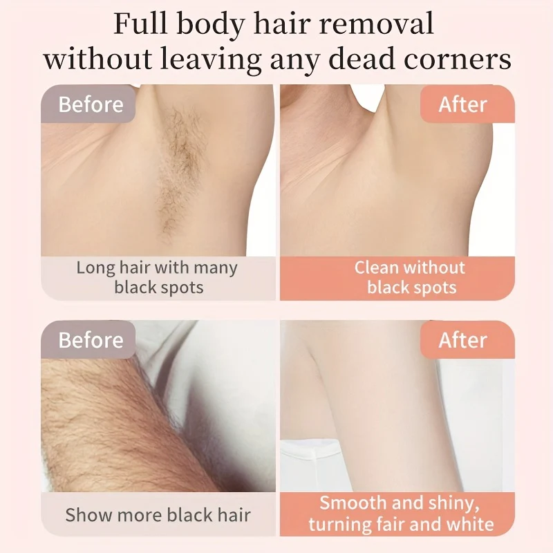 Épilateur électrique 2 en 1 pour usage domestique – Image 7